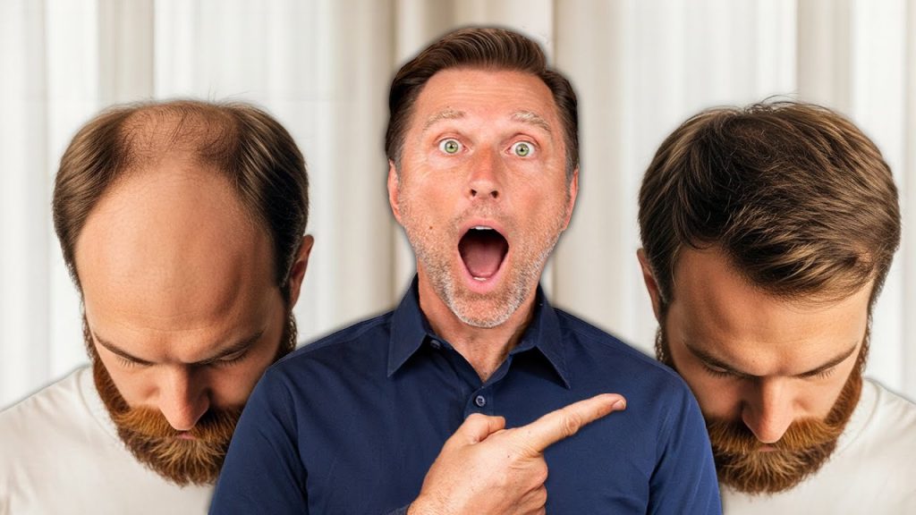 How to Reverse Hair Loss